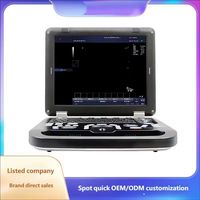 Échographe vétérinaire portable HD LCD avec sonde multicanal pour examen abdominal/cardiaque, fonction de congélation en un clic, facile à transporter