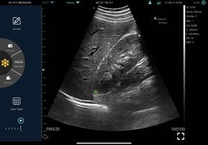 Sonde d'imagerie à ultrasons C10L de diagnostic de l'hôpital konted de pékin, applicable aux bébés et aux petits animaux - Product Image 6