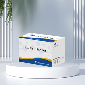 공장 판매 HBc 항체 항-HB 표면항원 ELISA 검사 키트 (인체용, 96회 테스트) - Product Image 2