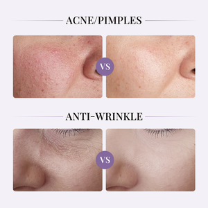 Ampolla Desechable de Esencia de Colágeno Recombinante Tipo III B.F.S. Profesional para Salón de Belleza, Hidratación Profunda, Cuidado Facial - Product Image 3
