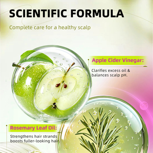 น้ำยาทำความสะอาดหนังศีรษะสูตรมินต์แอปเปิ้ลไซเดอร์วีนีการ์ พร้อมโลโก้สั่งทำพิเศษ เพื่อความสดชื่นยาวนาน ใช้ได้ทุกวัน - Product Image 5