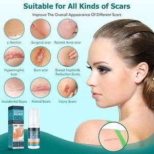 Aixin Private Scar Repair Advanced Scar Gel <span class=keywords><strong>ayuda</strong></span> <span class=keywords><strong>a</strong></span> mejorar la reparación de cicatrices antiguas y nuevas humedecer sin secar Gel reparador - Product Image 3