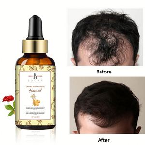 Soin capillaire en plantes naturelles pour femmes, supplément de bonne qualité, herbes naturelles, traitement pour la perte de cheveux, sérum pour croissance dense - Product Image 3