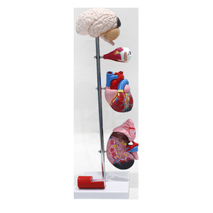 Modèle d'hypertension artérielle : un modèle comparative des vaisseaux sanguins normaux et malades ; un outil pédagogique médical. - Product Image 5