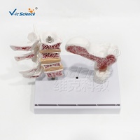 Modelo de Lesión de Osteoporosis en 2 Partes: Columna Vertebral y Fémur Proximal Patológicos, PVC Pintado a Mano, Ideal para la Educación del Paciente