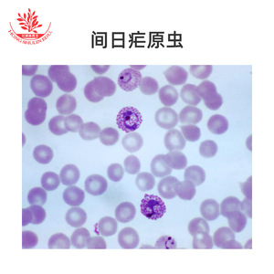 Portaobjetos de Plasmodium vivax, preparados biológicos de alta resolución para la enseñanza universitaria, vendidos en lotes de 10. - Product Image 4