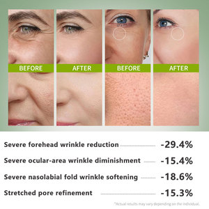 The Vita a Cream Retinal Shot Booster Raffermissant 15 ml Rides et ridules Raffermissant la peau Minimisant les pores Hydratant - Product Image 5