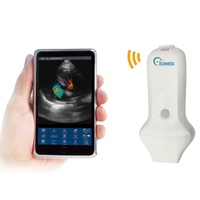 Escáner de Ultrasonido Doppler Color Inalámbrico EOMED Mini Phased Array, Frecuencia 2.5-3.6MHz, Velocidad de Fotogramas 15-20fps, Soporte para Obstetricia