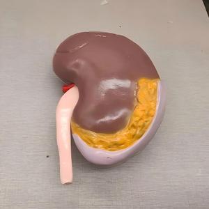 Modelo Anatómico Transparente del Segmento Renal Humano - Herramienta Educativa de <span class=keywords><strong>Nefrología</strong></span> - Product Image 5