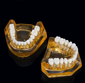 Modèle de dents détachable en PVC de haute qualité, taille double, pour l'apprentissage et la décoration des dents temporaires chez les enfants - Product Image 4