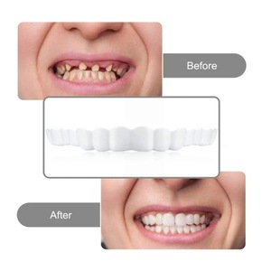 Veneer Gigi Pemutih Gigi Tiruan Kawat Gigi Sementara Gigi Palsu Kawat Gigi Senyum Sempurna Pas Nyaman Kit Veneer Gigi Tiruan - Product Image 5