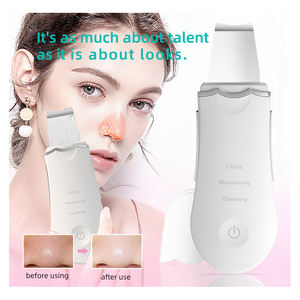 Espátula Eléctrica Ultrasónica para Limpieza Facial, Modelo Nuevo, Máquina Exfoliante de Piel Muerta, Venta al por Mayor Personalizada - Product Image 2