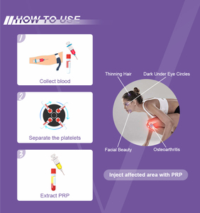 Virtuoze Bloedplaatjesrijke Plasmacentrifuge Gebruiken Medische Bloedprp Medische Apparatuur - Product Image 6