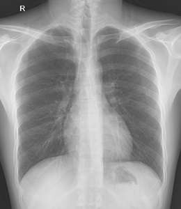 جهاز أشعة سينية رقمي للتشخيص الطبي للمستشفيات 500 مللي أمبير 40 كيلوهرتز 40-150 كيلو فولت 125 كيلو فولت - Product Image 5