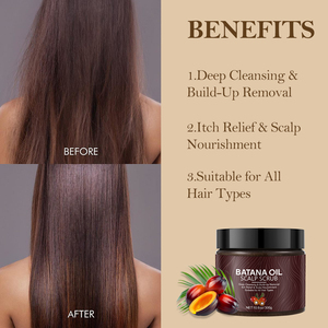 Masajeador DE CUIDADO DE Spa Saclp, champú de Etiqueta Privada, Limpieza Profunda, aceite de Batana, exfoliante para el cuero cabelludo para el crecimiento del cabello, picazón seca en el cuero cabelludo - Product Image 5