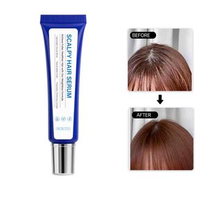 <b>Scalp</b> Essence Gel Cream Natural Dry <b>Scalp</b> Treatment with Soothing for <b>Scalp</b> Serum - Product Image 2