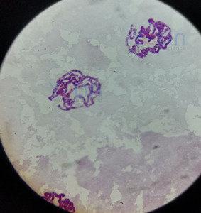 Lames préparées sur mesure pour microscopes de biologie et de sciences médicales, incluant des lames de chromosomes salivaires de Drosophila pour usage universitaire - Product Image 2