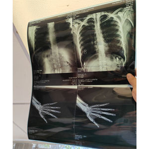 Careray dr detektor panel datar digital, aksesori peralatan radiologi perangkat lunak multi bahasa 1500cw 1800cw - Product Image 2