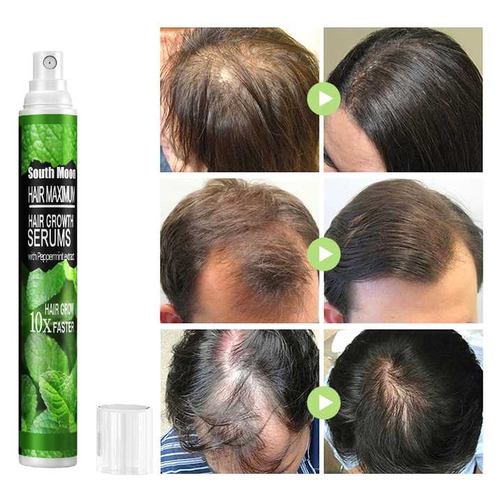 10ML Hair Growth Spray Mint Oils Spray Anti-Loss Solid Hair Black Long Hair Liquid Promote Head Epicuticle Blood Circulation