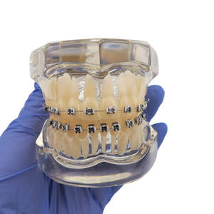 Modelo de Ortodoncia Typodont para Educación Dental con Brackets Metálicos y 28 Piezas Dentales - Product Image 1