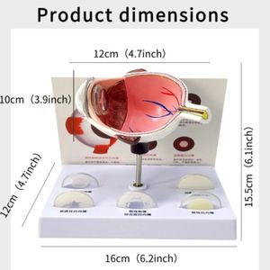 Fabricant ventes directes modèle d'oeil anatomique cataracte PVC matériel pour <span class=keywords><strong>ophtalmologie</strong></span> <span class=keywords><strong>collège</strong></span> médecin outils sciences médicales - Product Image 3