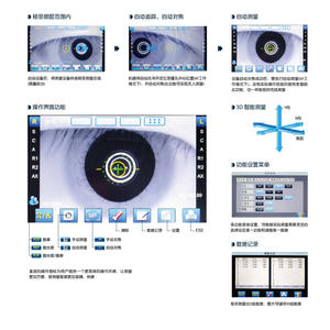 Refractómetro Computarizado Totalmente Automático Chang'e Ark7800L con Medición de Curvatura Corneal para Examen Ocular - Product Image 4