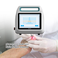 Sunrise Endo Lifting 980nm et 1470nm 50W Traitement efficace de l'onychomycose (mycose des ongles) Autres produits de beauté et de soins personnels