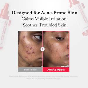 Spray facial quotidien à l'acide hypochloreux Medicube 125 ml, apaisant, hydratant, pour tous types de peaux - Product Image 4