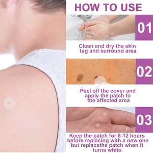 Private Label <strong>Skin</strong> <strong>Tag</strong> <strong>Removal</strong> <strong>Patch</strong>, Fast &amp; Easy to Use, Painless - Product Image 5