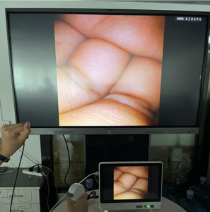 Endoscopio Veterinario Flexible con Video HD SY-P029-3, Diámetro de 2.8 mm, para Diagnóstico de Animales Pequeños - Product Image 6