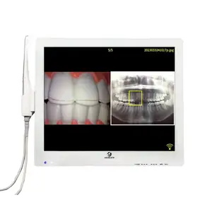 Hete Verkopende Camera Orale Wifi Tandheelkundige Klinieken Overdracht X Ray Foto Intraorale Camera