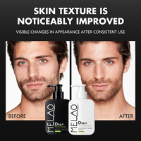 Hydratant pour le visage à la céramide OEM Crème hydratante réparatrice pour soins de la peau pour hommes non comédogène Crème hydratante pour le visage à la céramide NP pour hommes