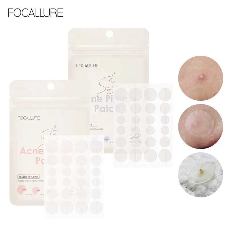 FOCALLURE FA186 علاج بقعة حب الشباب البثور حب الشباب التصحيح بثرة الشفاء التصحيح