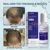 Shampoo, après-shampoing et sérum pour la repousse des cheveux avec 5% d'actifs et des bloqueurs naturels du DHT, traitement complet pour les cheveux clairsemés et la perte de cheveux