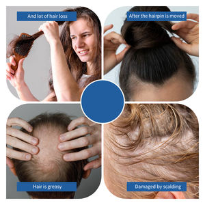 Creme de Ervas Personalizado OEM para Recrescimento Capilar e Sérum para Cuidado do Couro Cabeludo com Função Reparadora - Product Image 3