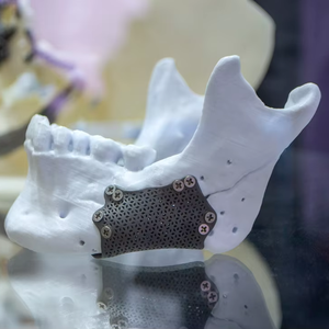 Plantilla Quirúrgica de Precisión Impresa en 3D de Latón para Guía de Osteotomía Ortognática, Piezas Personalizadas para Cirugía Oral y Localización Médica - Product Image 1