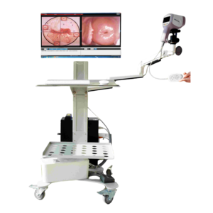 Desain baru <span class=keywords><strong>Video</strong></span> medis endoskopi mesin colonoskop dokter hewan endoskopi kamera untuk ginekologi - Product Image 2