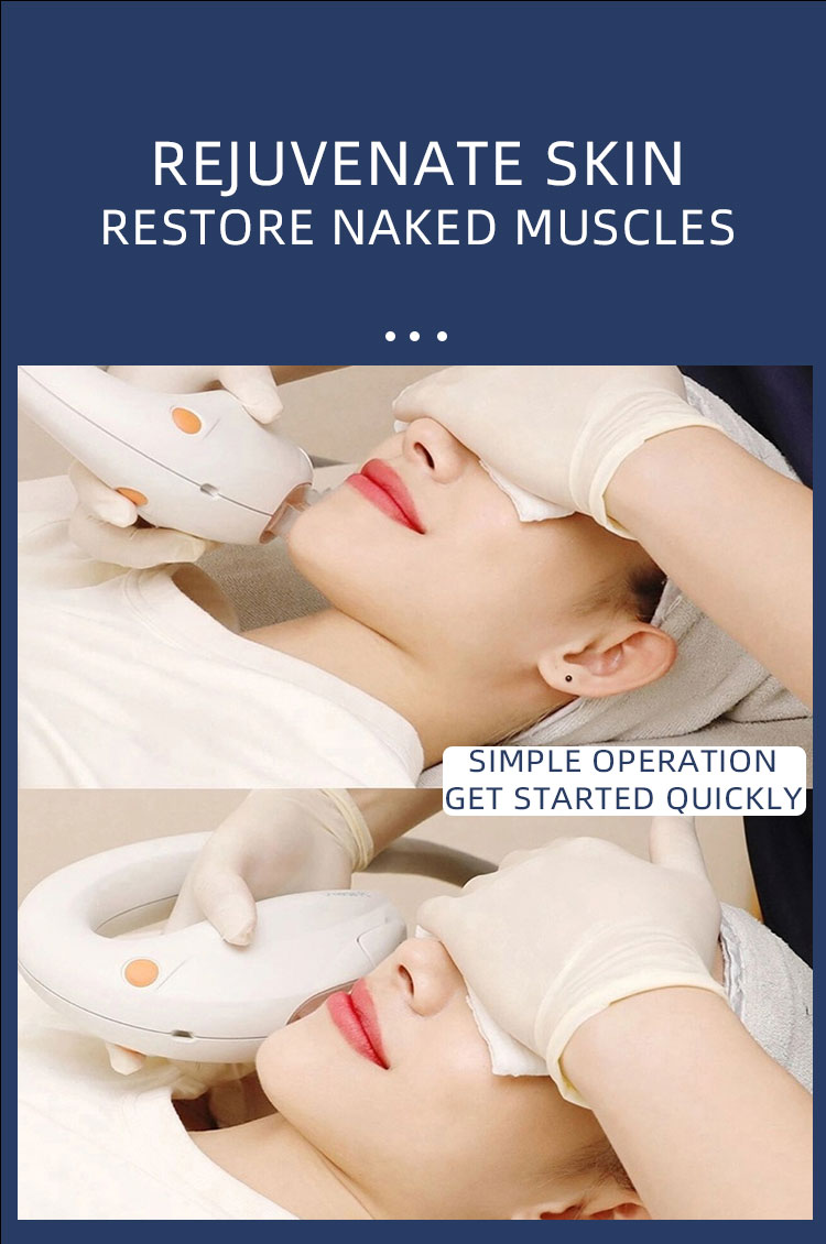 Epilator DPL Laser Hair Removal