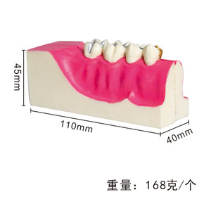 แบบจำลองกายวิภาคศาสตร์ฟันที่ถูกผ่าตัดของฟันด้านหลังขวาล่าง อุปกรณ์และอุปกรณ์เสริมสำหรับการรักษาทางช่องปากสำหรับการศึกษาทางทันตกรรม - Product Image 4