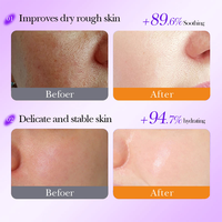 Crema Facial Antienvejecimiento con Retinol y Péptidos 30g, Escualano Reafirmante, Iluminador, Suavizante de Líneas Finas, Venta al por Mayor de Productos para el Cuidado de la Piel
