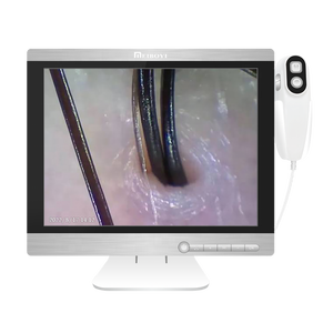 15.5 Inch HD Display With 2 Detector Portable Scalp Dandruff Damaged Skin Analysis Hair Machine Scalp Camera 32GB RAM - Product Image 1