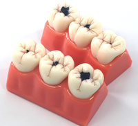 Modelo anatómico de enfermedad de caries dental con resina de aumento 3x modelo de cabeza de ciencia médica de PVC para escuelas entrenamiento de hospitales