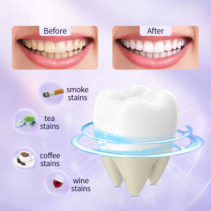 Kit Pemutih Gigi Nirkabel Isi Ulang Terbaru 2025 Lampu LED UV Label Pribadi 3 <span class=keywords><strong>Gel</strong></span> Pemutih Perlengkapan Pemutih Gigi untuk Penggunaan di Rumah - Product Image 4
