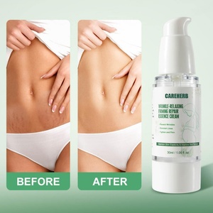 Crema ODM OEM Nutritiva y Rejuvenecedora de la Piel, Previene las Líneas Finas, Reafirmante, Antiarrugas y Relajante, Elimina las Estrías - Product Image 6