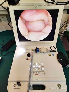 Mesin endoskopi kaku laparoskop medis portabel harga mesin endoskopi sistem operasi hd - Product Image 5