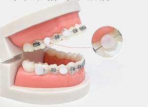 Groothandel Individueel Verpakte Reisorthodontische Was Om Orthodontische En Tandheelkundige Implantaatwrijvingspijn Te Verlichten - Product Image 6