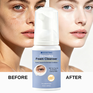 Nettoyant Moussant OEM/ODM Anti-Mites et Anti-Imperfections pour Peaux Sèches, Contrôle du Sébum, Nettoyage en Profondeur, Réduction des Pores, Hydratant et Éclaircissant (pour le soin du visage) - Product Image 1