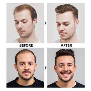 Capsule per Capelli OEM ODM Etichetta Privata, <span class=keywords><strong>Best</strong></span> Seller per Adulti, Riduzione Caduta Capelli, Integratore Alimentare Naturale con Biotina, Vitamina e Collagene in Softgel - Product Image 2