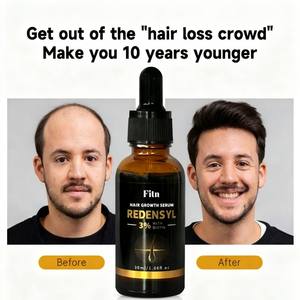 วิตามินรวม2-in-1สำหรับผมมังสวิรัติบำรุงผมสูตรเพื่อสุขภาพผิวแบบอินทรีย์ฉลากส่วนตัว - Product Image 4