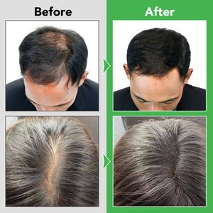 Kit de soin capillaire anti-chute de cheveux <span class=keywords><strong>Rogaine</strong></span> 100% naturel et biologique, shampooing et revitalisant à <span class=keywords><strong>la</strong></span> lavande - Product Image 4